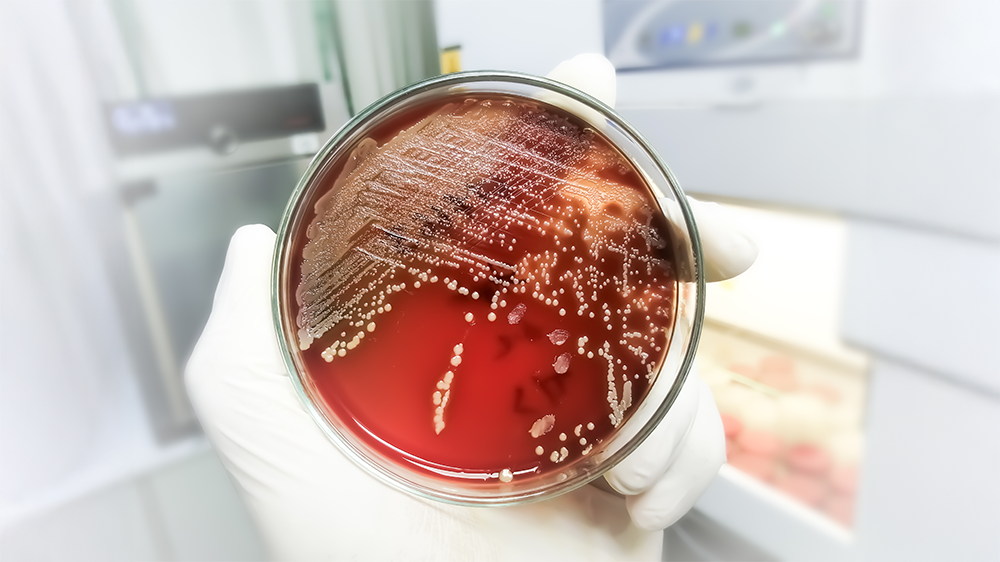 WINNING THE FIGHT AGAINST SUPERBUGS